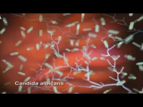 Comment soigner une mycose vaginale Naturellement