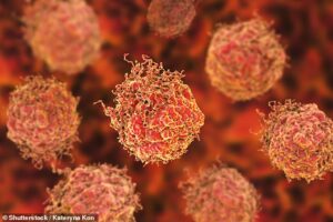 Des essais cliniques ont maintenant commencé - dans le but de libérer des globules blancs cancérigènes pour attaquer la tumeur.  Les cellules cancéreuses de la prostate sont vues ci-dessus