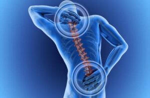 Quelles sont les causes des maux de dos ?