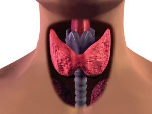 Symptômes d'un possible cancer de la thyroïde chez les ...