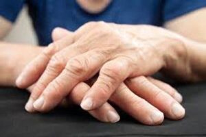 Une nouvelle technique pour traiter l'arthrite