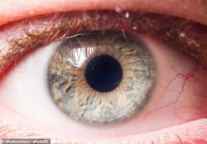 Glaucome : un nouveau test sanguin 15 FOIS plus susceptible d'identifier les personnes à haut risque avant la perte de vision
