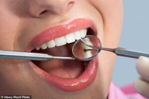 Deux dentistes au Royaume-Uni ont décrit ce qu'il faut rechercher dans votre bouche qui pourrait être le signe de quelque chose de grave - y compris une croissance rouge sur la gencive pourrait être un signe de grossesse (image de fichier)