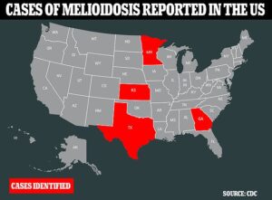 Le CDC a identifié quatre cas de mélioïdose, une maladie tropicale rare que l'on trouve généralement en Asie du Sud - et qui n'est amenée aux États-Unis que lors de voyages internationaux