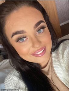 Amy Wiseman, 21 ans, de Durham, recevait du remplissage pour les lèvres d'une esthéticienne «de confiance», qui n'avait pas de formation médicale, depuis l'âge de 17 ans. Amy est photographiée après avoir subi un précédent traitement de remplissage pour les lèvres.