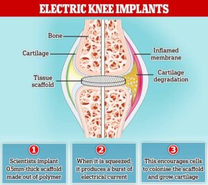 Des scientifiques font repousser le cartilage du genou avec un courant électrique