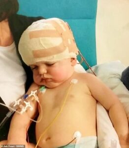 Daniel Bradley (photographié en 2012), d'Alfreton dans le Derbyshire, a reçu un diagnostic de craniosynostose rare à l'âge de trois mois, qui ne touche qu'un bébé sur 2 500.  Elle survient lorsque les articulations du crâne fusionnent, ce qui signifie qu'il n'y a pas assez de place pour que le cerveau se développe