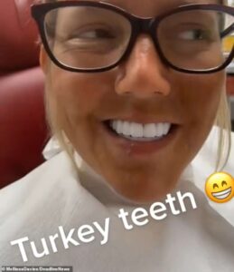 Melissa Davies, 35 ans après s'être fait refaire les dents dans une clinique dentaire sur la côte turque