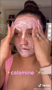 On voit la créatrice de TikTok appliquer une lotion à la calamine sur son visage avant d'ajouter du fond de teint et d'autres maquillages