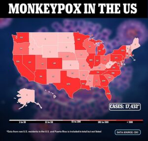 Le Texas enregistre le premier décès aux États-Unis dû au monkeypox