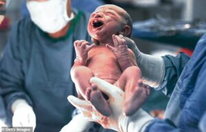Les scientifiques ont mis au point un test simple utilisant du ruban adhésif qui peut prédire si les nouveau-nés développeront un eczéma infantile