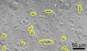 Ci-dessus, quelques-uns des spermatozoïdes de taureau de l'étude.  Les cercles jaunes indiquent qui nagent en groupe dans l'image ci-dessus