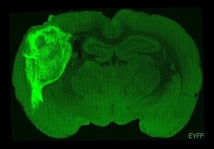 L'image ci-dessus montre un cerveau de rat qui a été transplanté avec du tissu humain (en surbrillance)