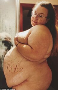 Naomi Smith, d'Écosse, est maintenant si grosse qu'elle a du mal à entrer dans le bain et supplie le public de l'aider à financer une opération de perte de poids en Turquie