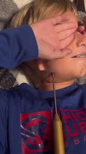 Sur la photo, Brycen Wright, 10 ans, se fait visser la mâchoire par sa mère